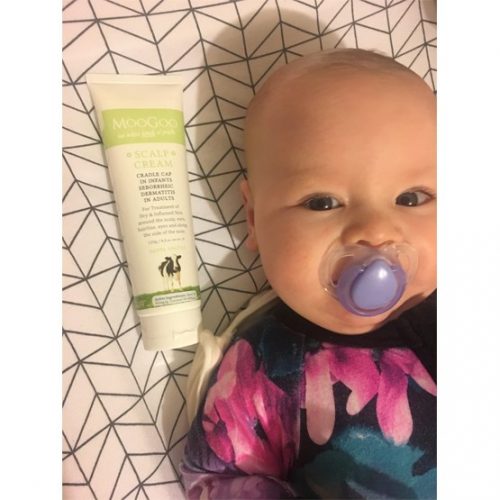 moogoo cradle cap